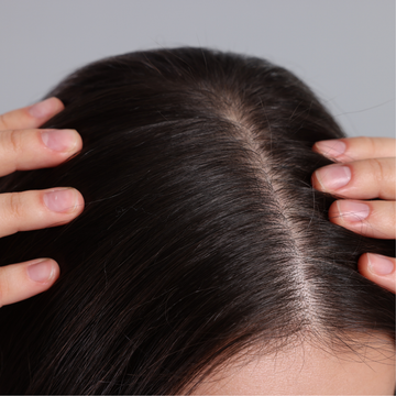 MEOD Beauty & Aesthetics - Scalp Micropigmentation Blog