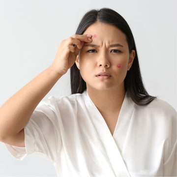 MEOD Beauty & Aesthetics - Acne and Facial Treatments