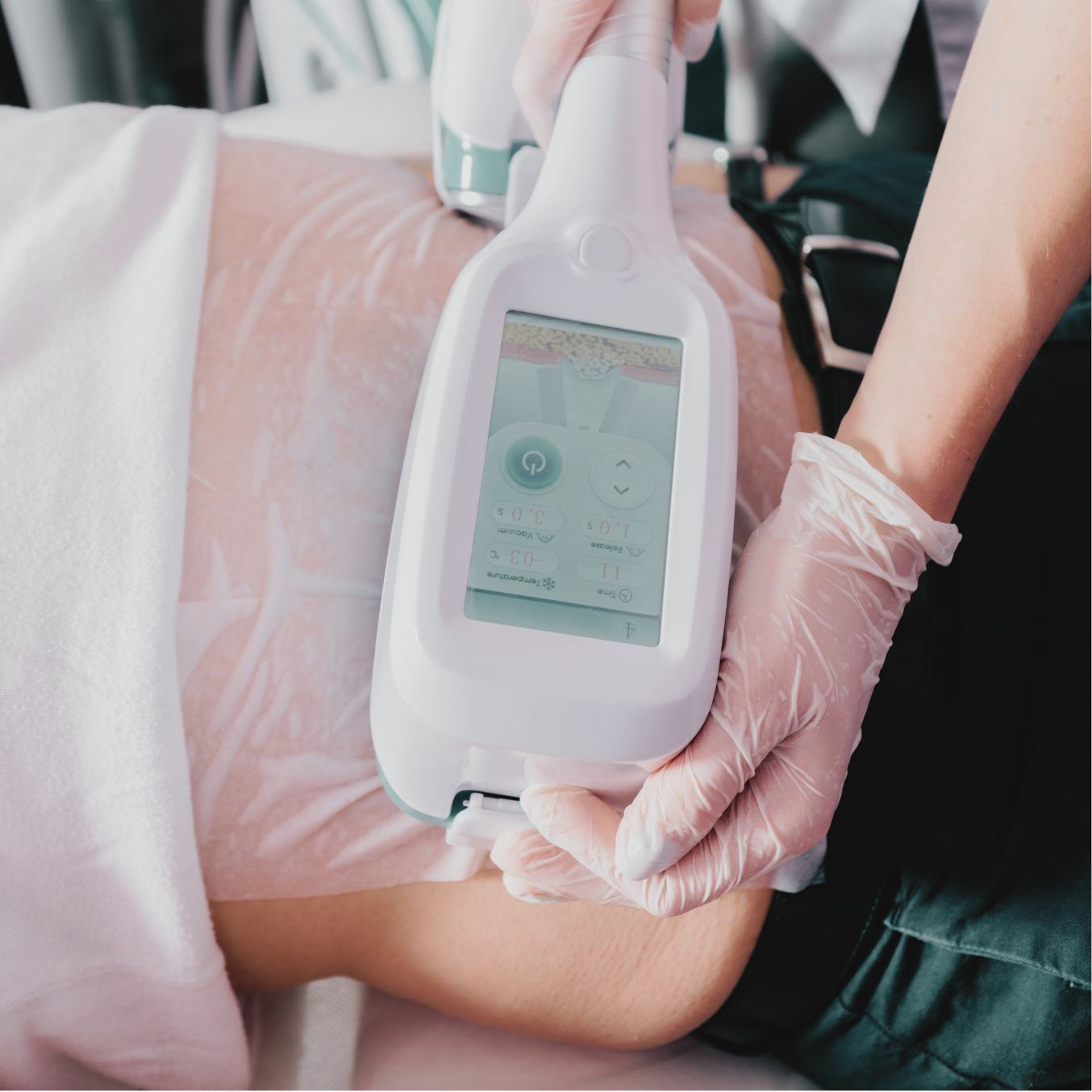 MEOD Beauty & Aesthetics - Body sculpting fat freeze