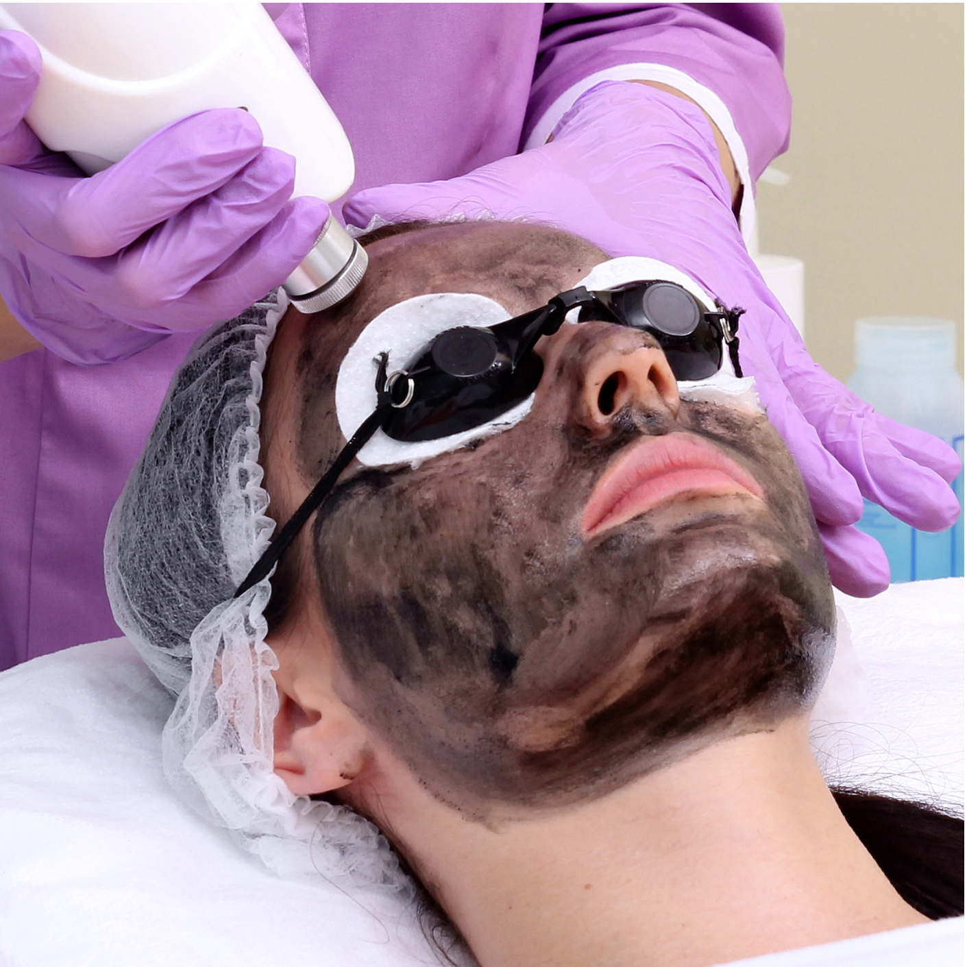 MEOD Beauty & Aesthetics - Carbon Peel Facial