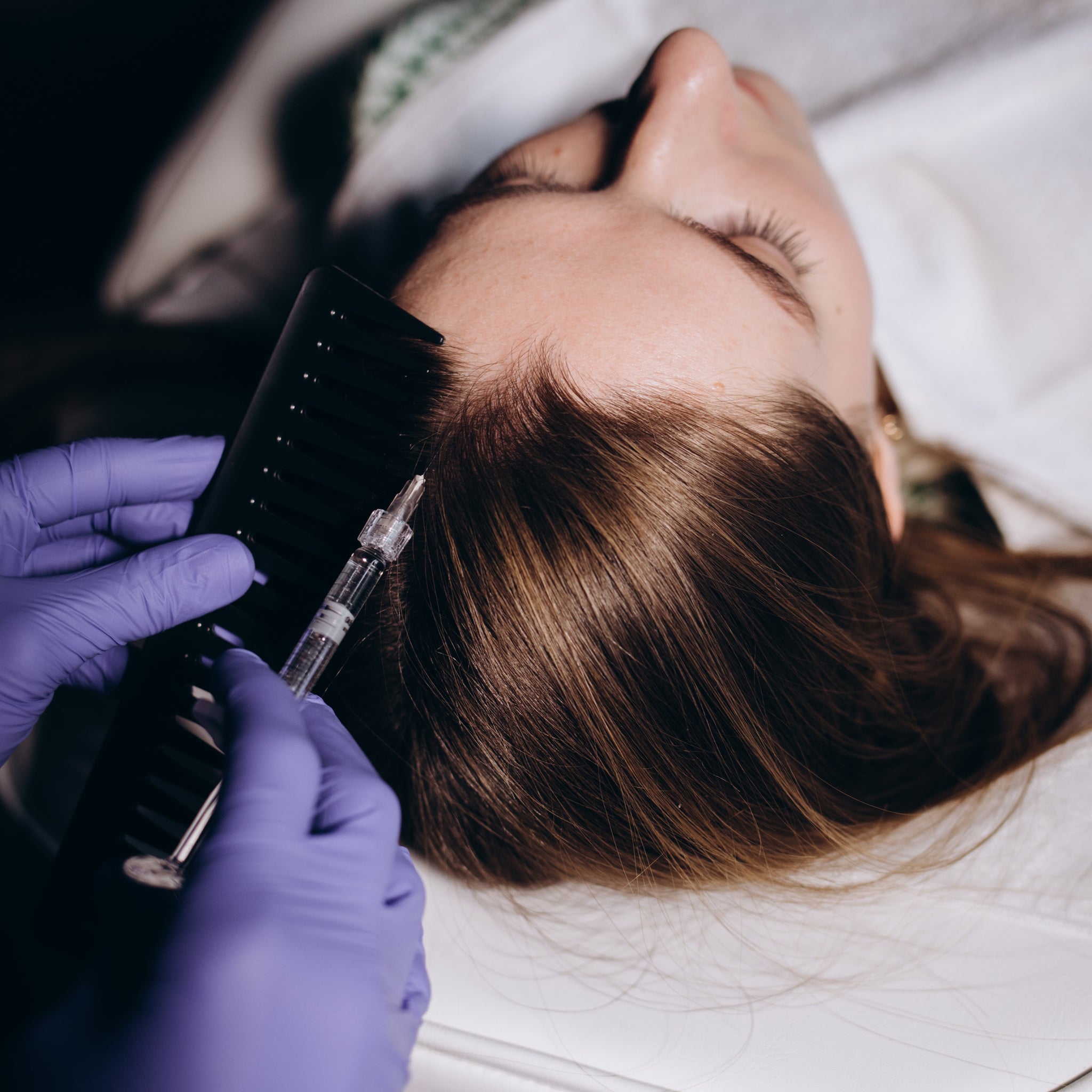 MEOD Beauty & Aesthetics - Crown/Scalp area Scalp Micro-pigmentation (SMP)