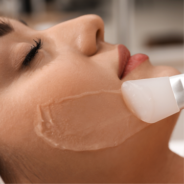 MEOD Beauty & Aesthetics - Customised Carbon Peel Facial