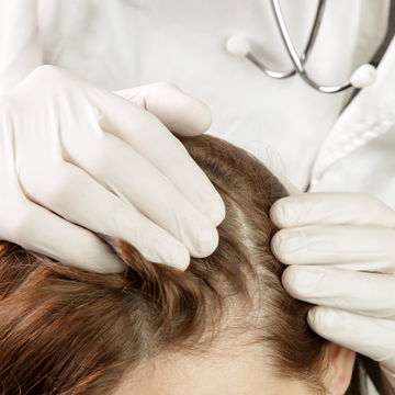 MEOD Beauty & Aesthetics - Front Hairline Scalp Micro-pigmentation (SMP)