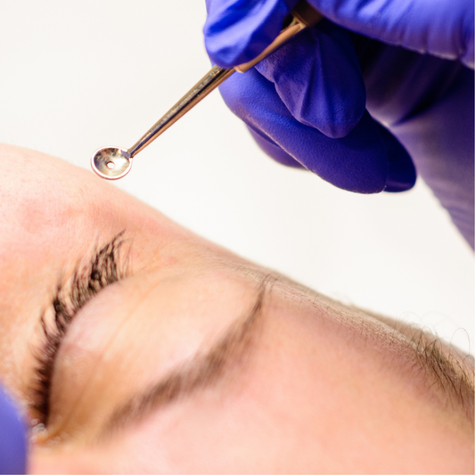MEOD Beauty & Aesthetics - Milia Seed Removal Facial Service