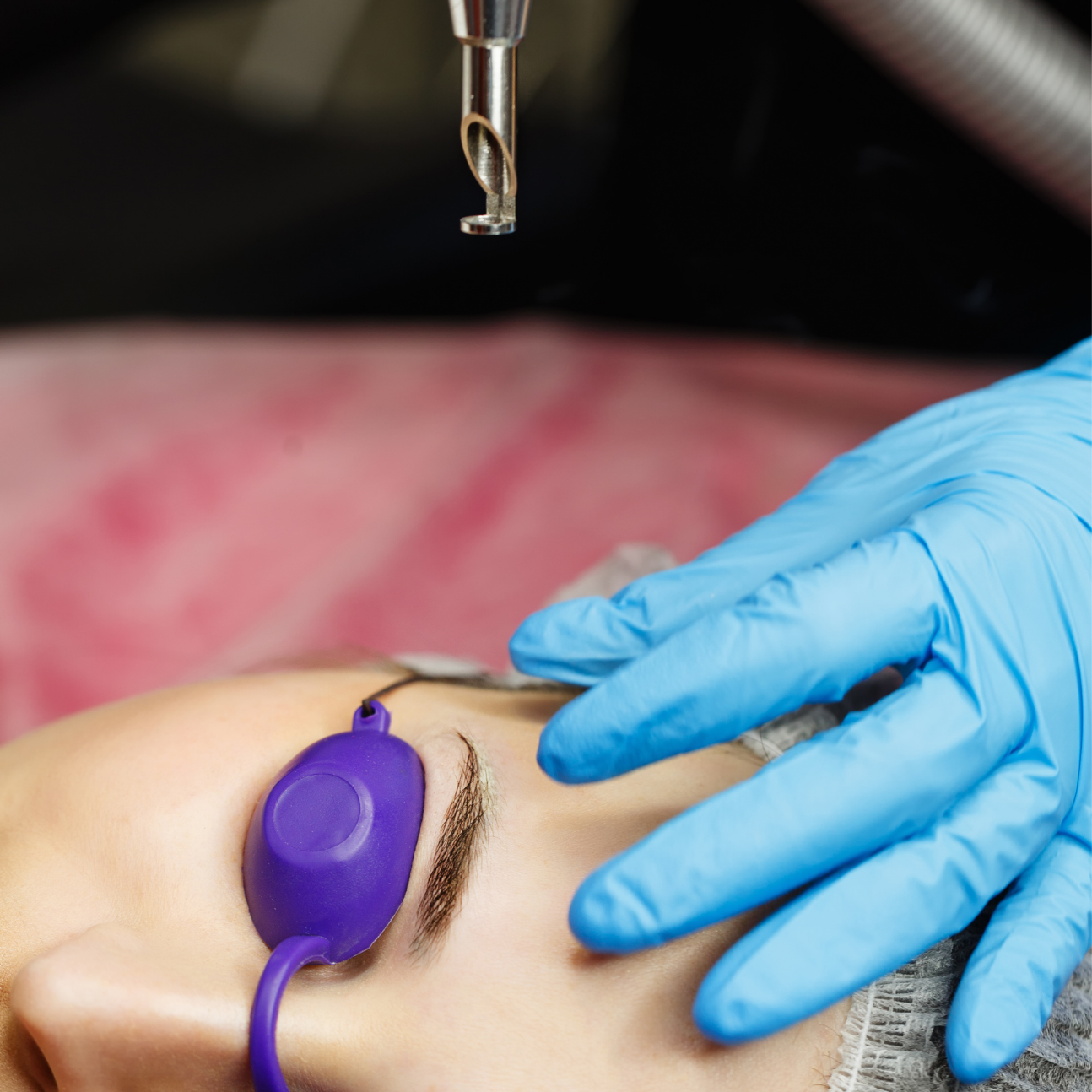 MEOD Beauty & Aesthetics - Other Treatments - Eyebrow Tattoo Removal